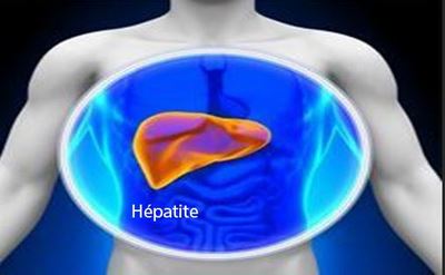 Hépatite B Causes Symptômes Traitements Naturels. Plantes Pour Vaincre l'Hépatite
