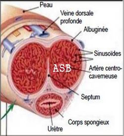 Athérosclérose Causes Traitement Naturel