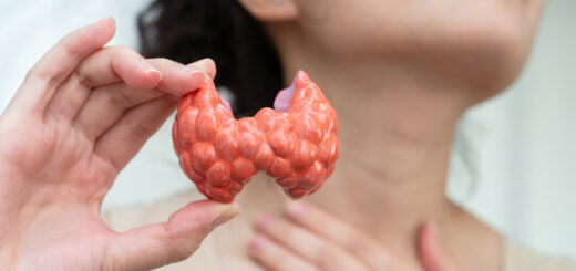 Goitre Causes Symptômes Préventions Remède Naturel du Goitre