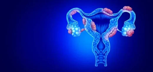 Comment Traiter Naturellement l' Endométriose pour Tomber Enceinte facilement ?